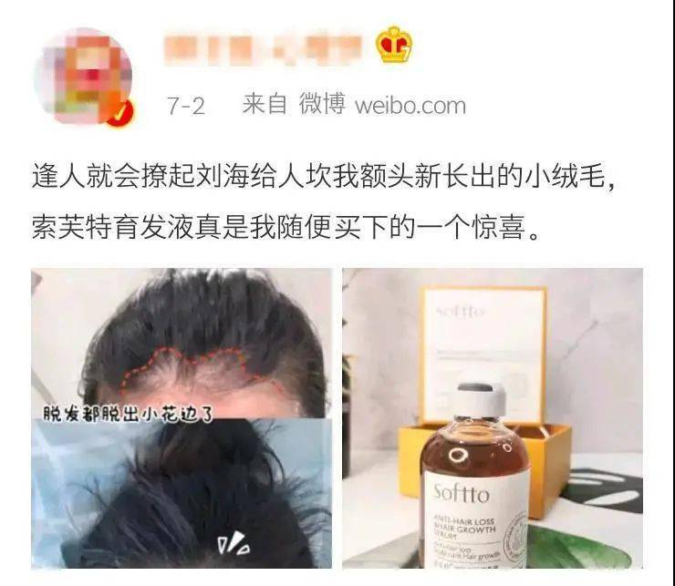 索芙特|超强国货生发!1个月发际线被填满,半年发量暴增!