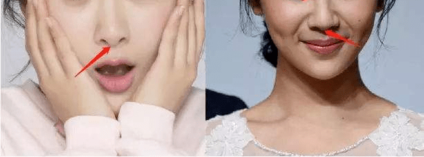 皮肤|翻红女星这都几年没接戏了，还敢这么浪呢？