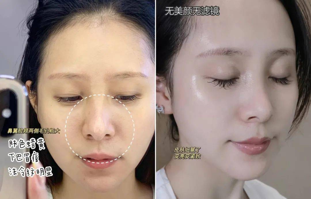 皮肤|翻红女星这都几年没接戏了，还敢这么浪呢？