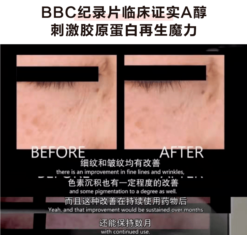 皮肤|翻红女星这都几年没接戏了，还敢这么浪呢？
