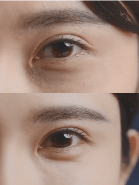 眼睛|32岁“国民老婆”喜当妈？！冻龄“眼”技完虐21岁女儿，做好这一步，真得会显年轻！