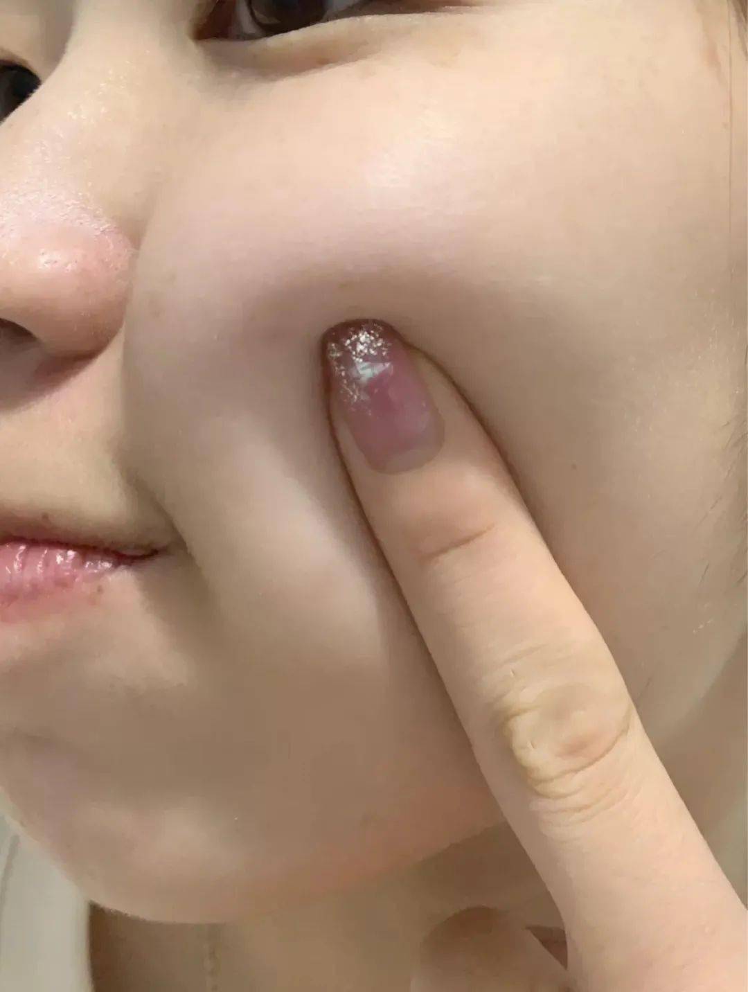 皮肤|刷酸=换脸？这个明星们超爱的百元刷酸好物搞定你的痘痘、闭口、黑头毛孔粗大还不怕烂脸！