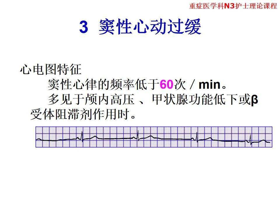 【ppt】异常心电图及常见心电图的识别及处理