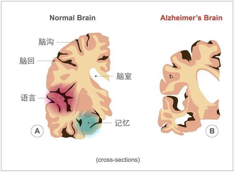 人口萎缩_中国人口面临大幅萎缩, 后浪 没了怎么办(3)