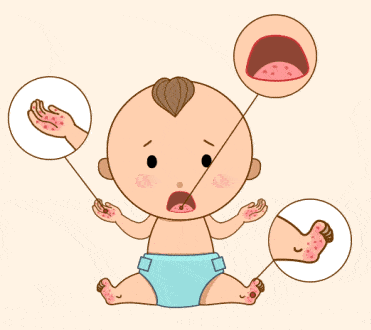 症状|我们为您支招【水霖幼儿园】秋季保健