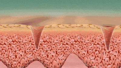 拖鞋|爱穿凉鞋、拖鞋出门的女人,脚上露出这个东西也太丑了吧~