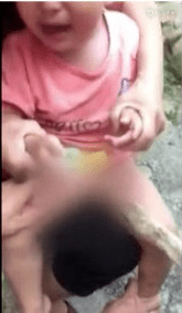 宝宝|爸妈听信偏方，一个决定害死了娃1岁孩子烫伤后