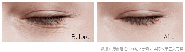 黑眼圈|430年的马应龙放大招,八宝古方做的眼霜,眼纹淡了