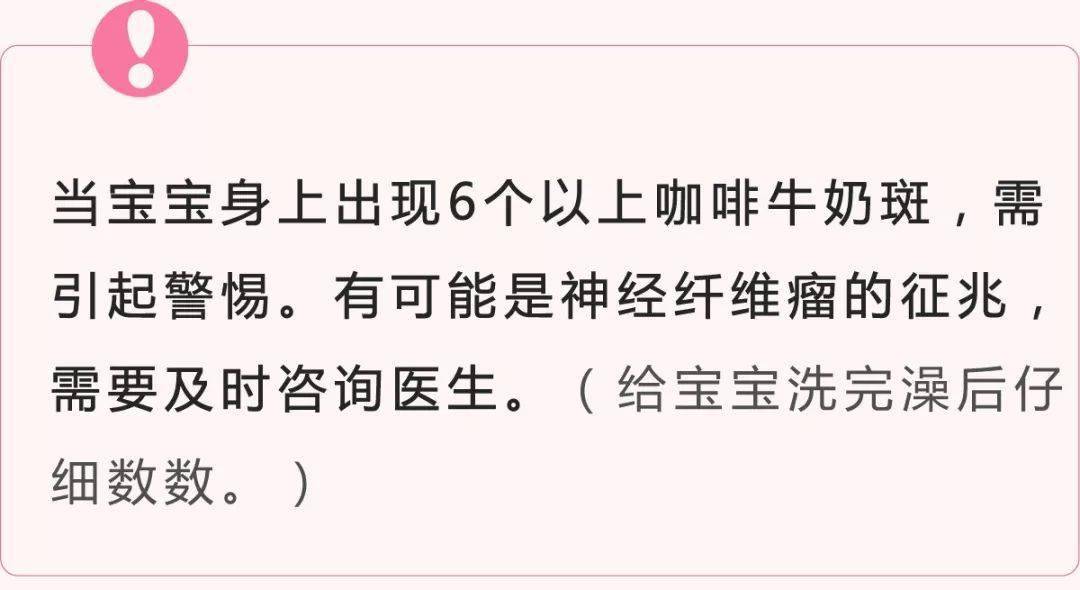 治疗|一定要看!医!生!宝宝的胎记真不用管吗?错!如果长这样