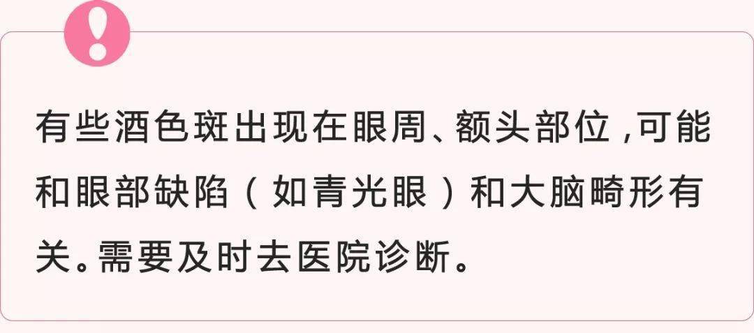 宝宝的胎记真不用管吗?错!如果长这样,一定要看!医!生