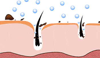 头发|头皮发痒，出油，还掉发？原来是你的洗发水没选好...