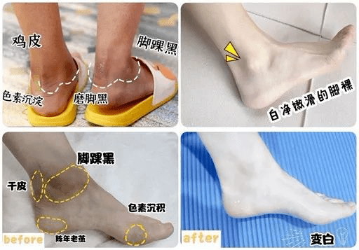 小说|长了一张「小说女主脸」是什么体验?