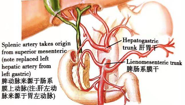 画说解剖变异一文读懂8种腹腔干常见变异