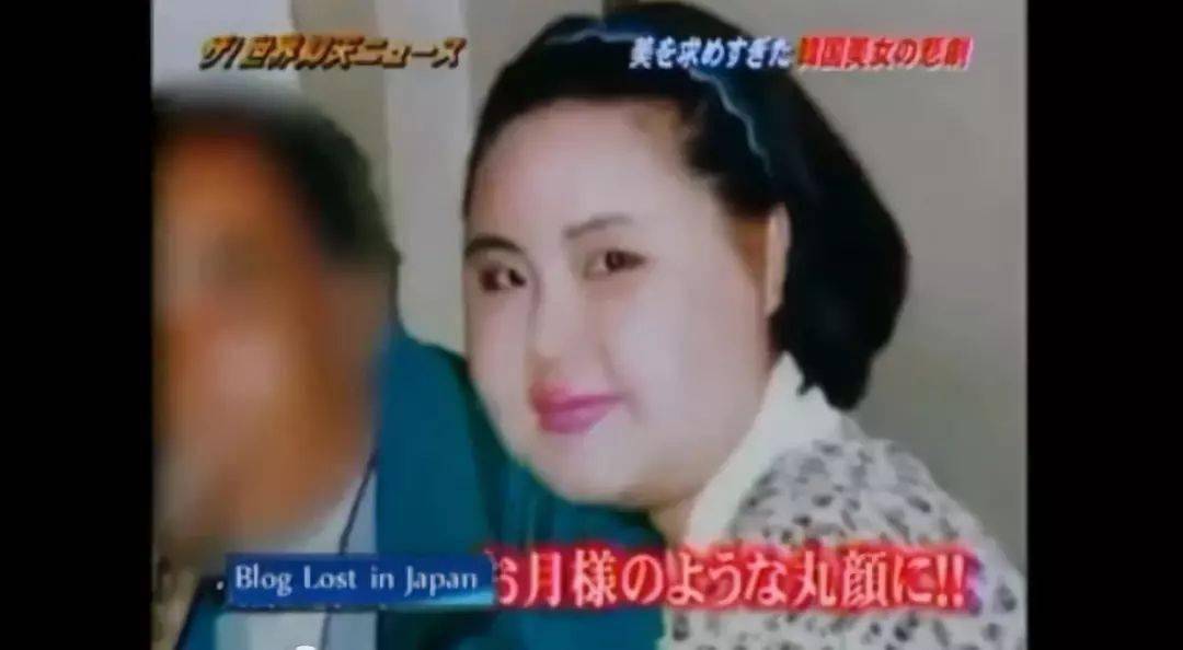 双眼皮|“我花了100万，把女儿整成了残废”：暑假整容风潮后，有20万女孩正在消失……