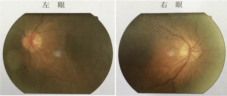 检查|遇到患者不再慌!手把手教你如何根据指南明确诊疗思路