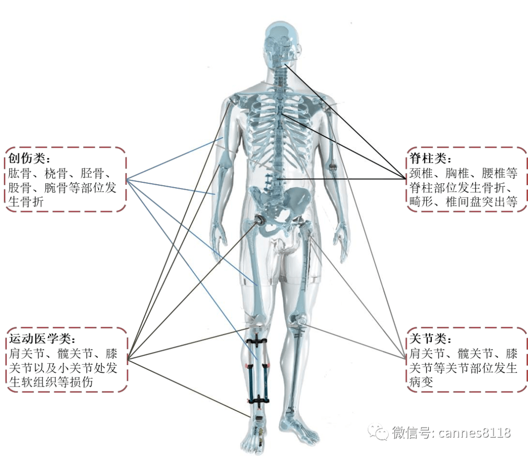骨科经典图谱 : 脊柱与脊髓的临床解剖_医学界-助力医生临床决策和职业成长