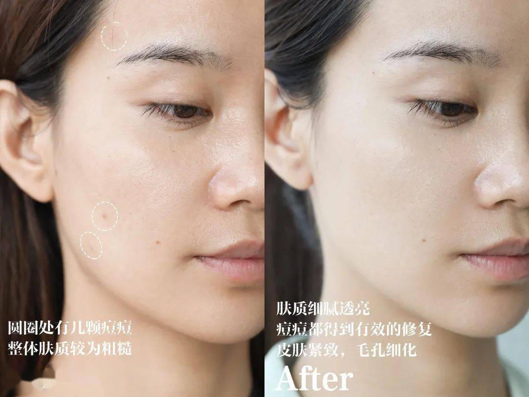 修护|LA MER五款面霜怎么选？看这篇get专属定制！