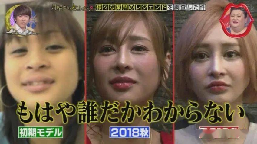 妹子|霓虹妹子整容上百次＂走上人生巅峰＂，以后还想整成桥本环奈…