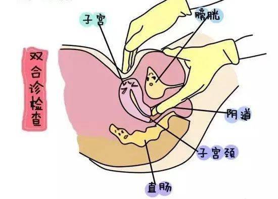 双合诊检查