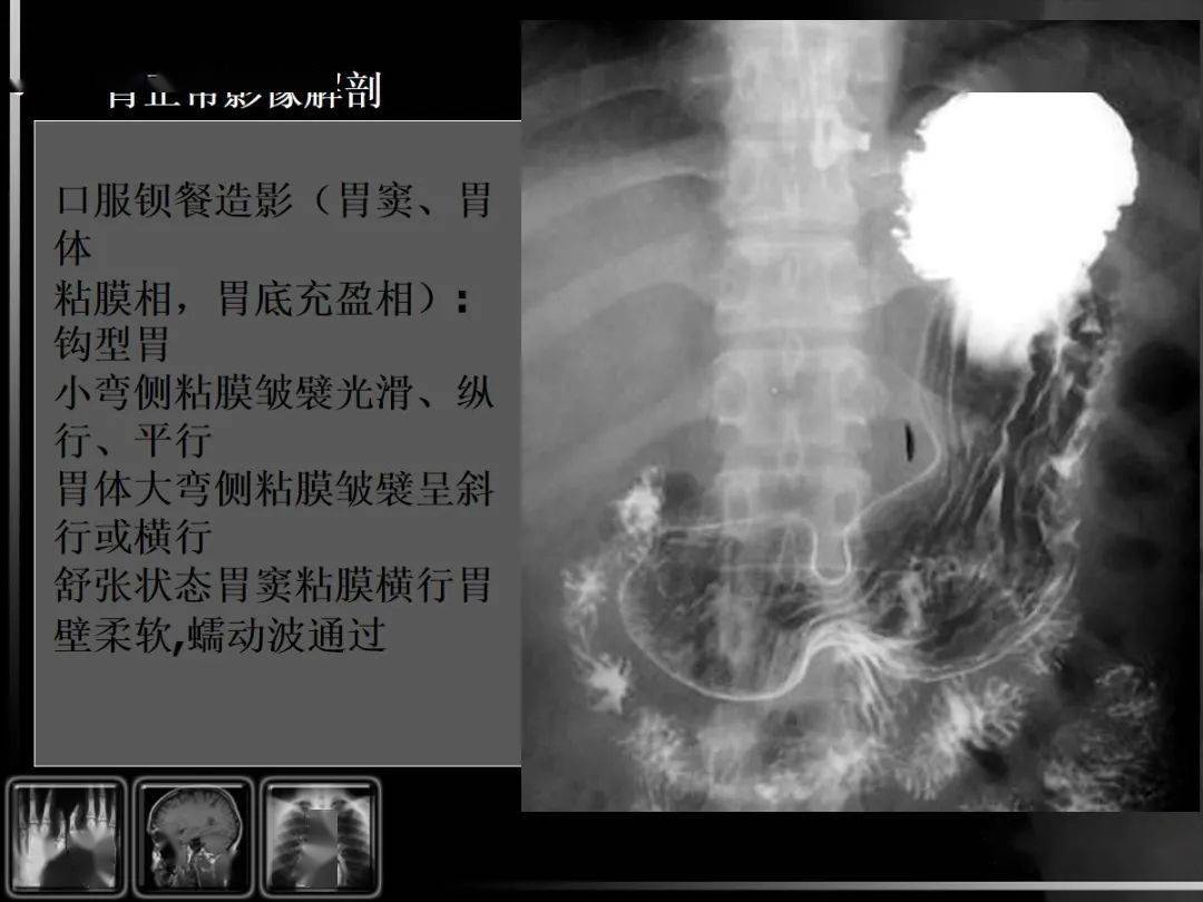 消化道疾病影像诊断与鉴别