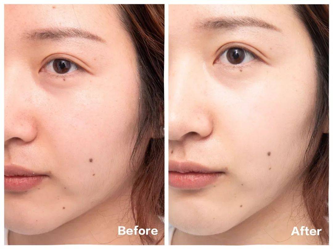 肌肤|樱花妹满脸的胶原蛋白,都是这个日本“小棕瓶”抹出来的