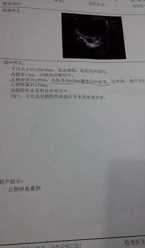 卵巢囊肿连续三年体检无变化一手术却发现成了恶性肿瘤