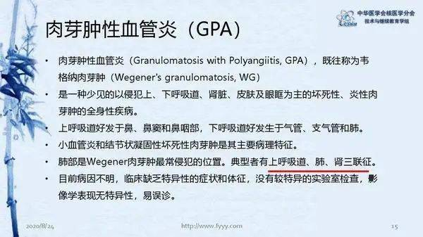 病例82期郑山肉芽肿性血管炎petct显像一例