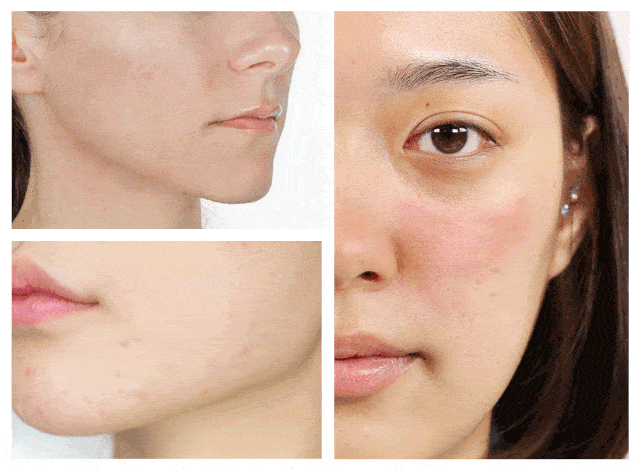 call|常年生活在0下20度！但这些极地女生的皮肤依然嫩到掐出水，都是这款芬兰国宝护肤品的功劳！李佳琦也在疯狂打call！