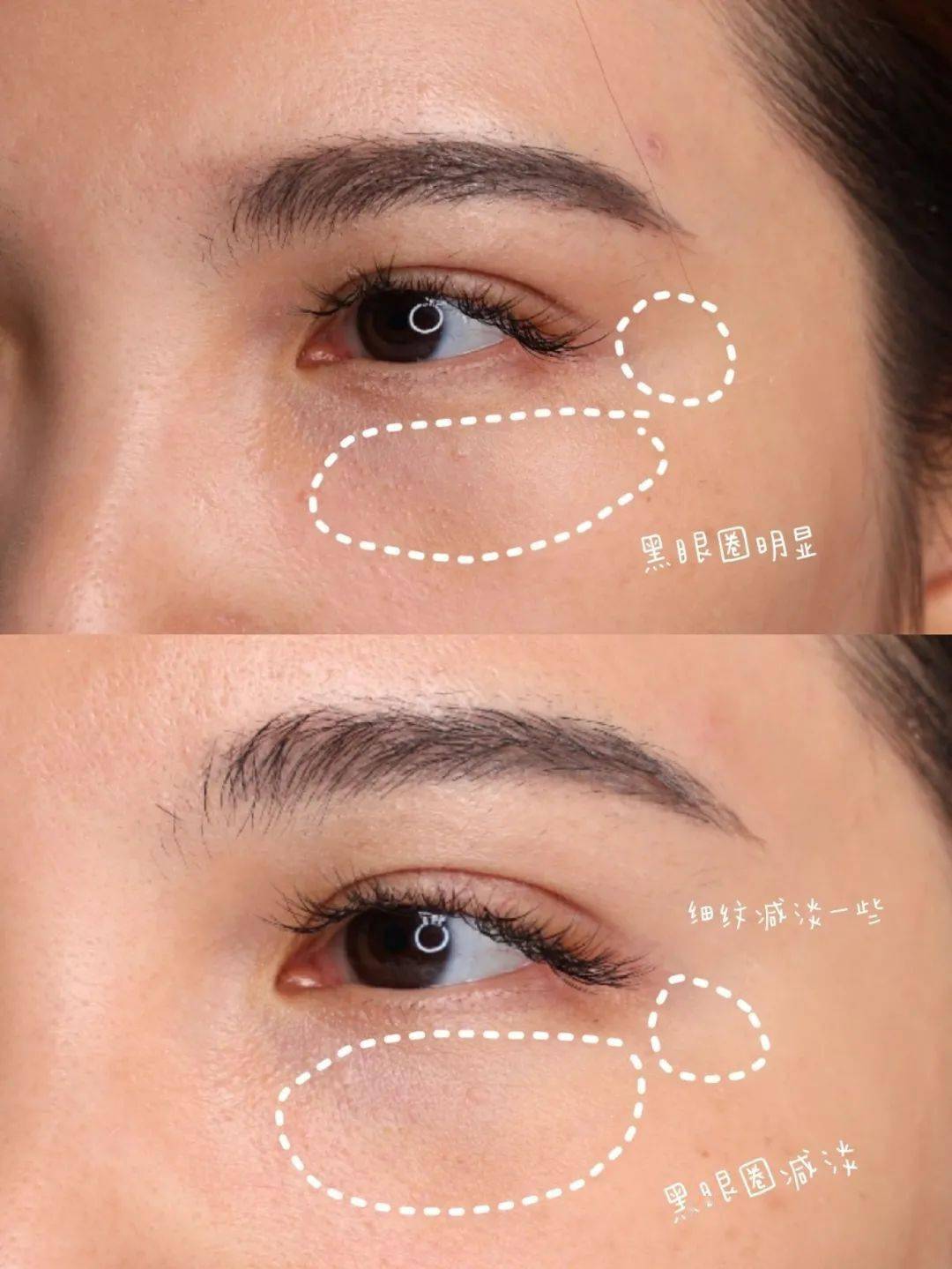 智商|捌种草 | 说眼霜都是智商税的，那是你还没遇到它！