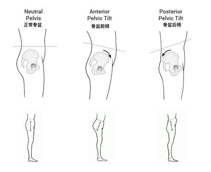 如何调节骨盆的各种倾斜?