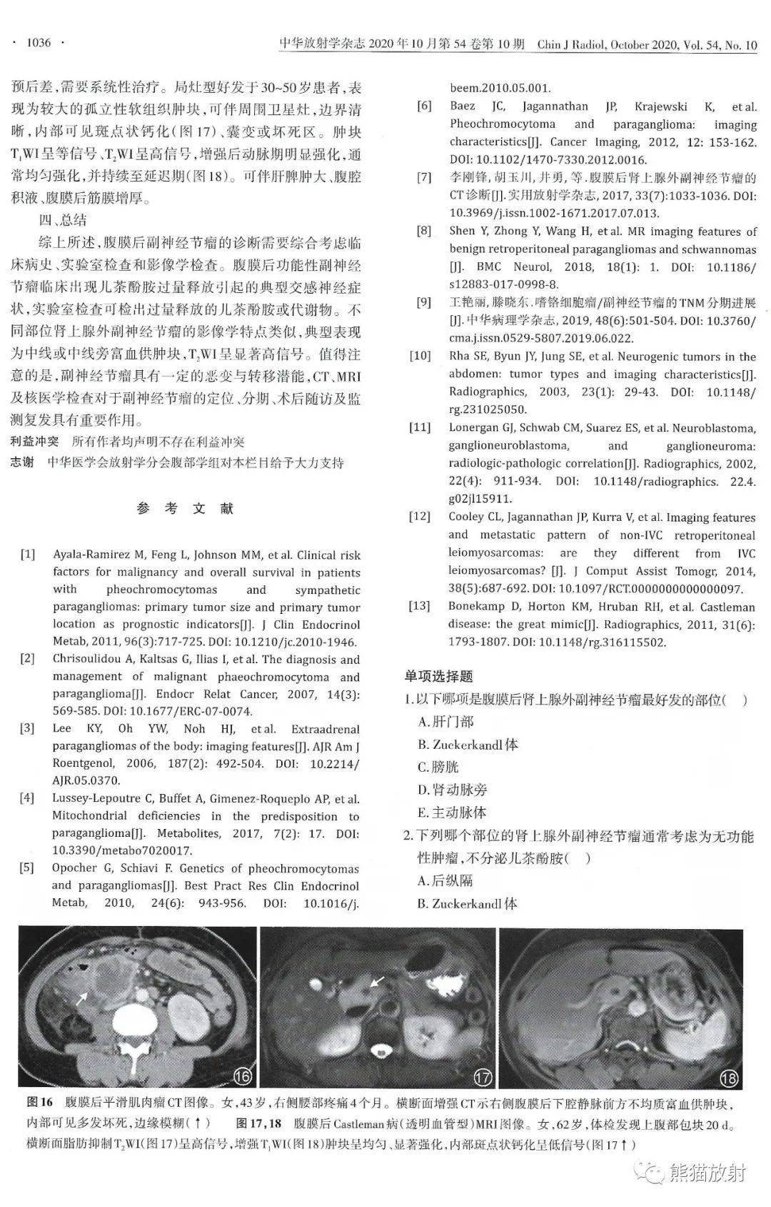 腹膜后副神经节瘤丨影像学诊断与鉴别诊断