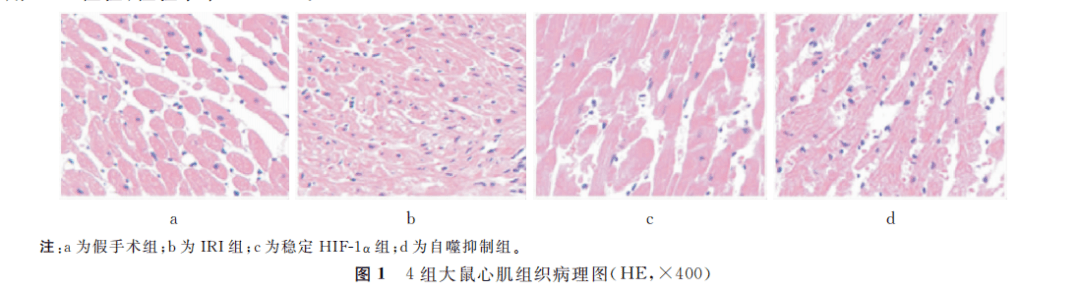 3 4组大鼠心肌组织hif-1α,lc3-Ⅱ,bnip3蛋白相对表达量比较再灌注2h