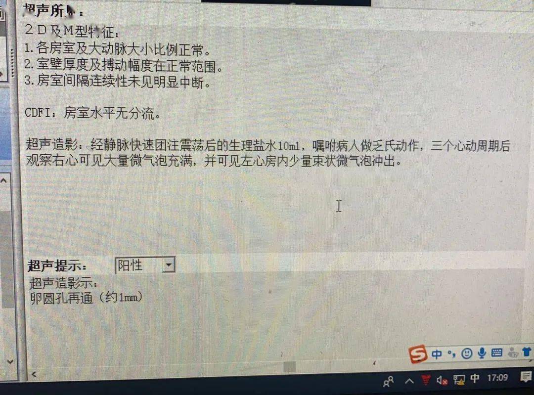 右心声学造影技术 | 头痛不妨查查心