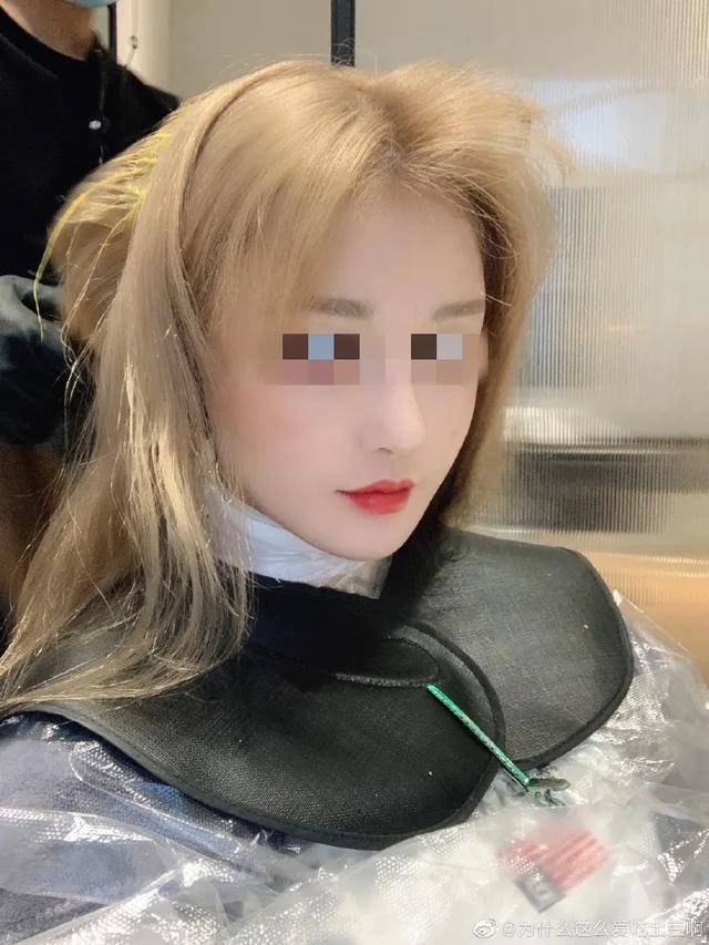 直播|顶着发泡的馒头脸，却自称医美教母，教唆粉丝整容反遭毁容