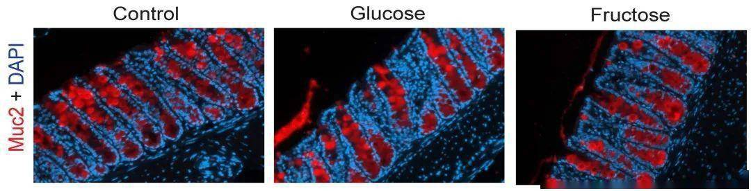 研究|【新研究】高糖饮食会损害肠道健康，加大结肠炎风险！