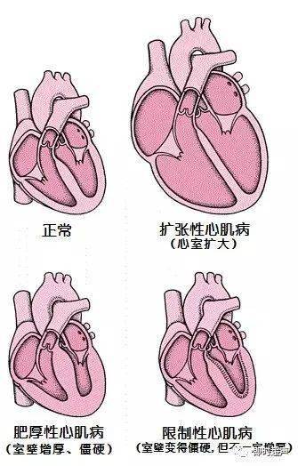 z型腔怎么搭_囗腔溃疡怎么治疗