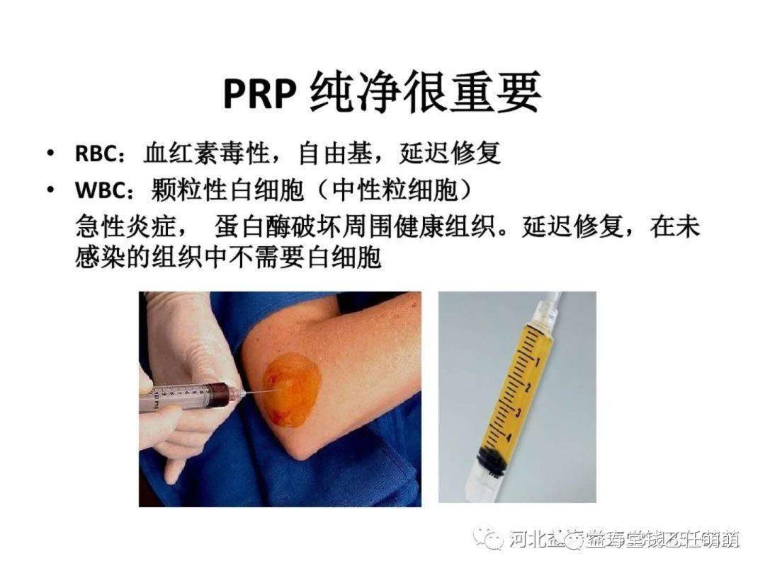 12月prp在骨病和创面临床应用学习班石家庄站