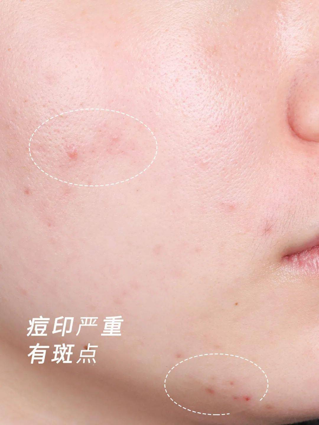 修护|双十一省钱攻略，打工人终于实现购物自由了！