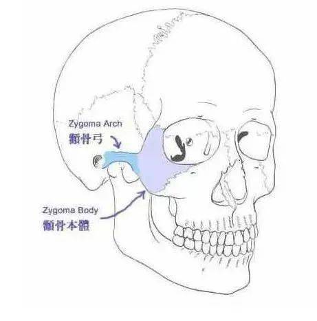 骨骼方面,颧骨高或鼻基底凹陷,都会让法令纹看起来较为明显.