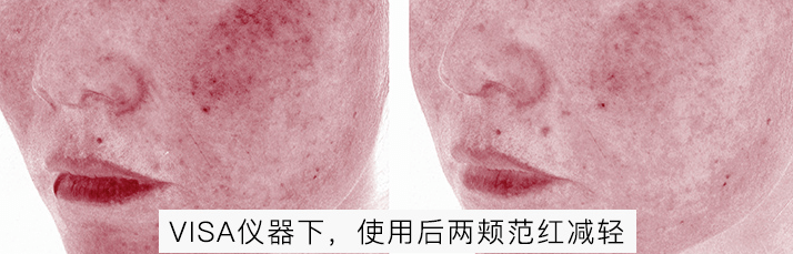 肌肤|嫩到掐出水！用一次比敷100片面膜还白润，10分钟感受女星同款水光肌！