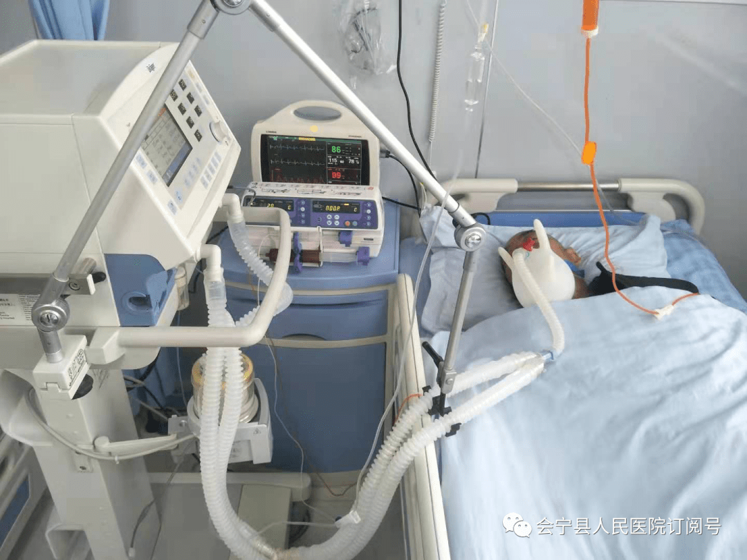 危重患者气管插管佩戴有创呼吸机