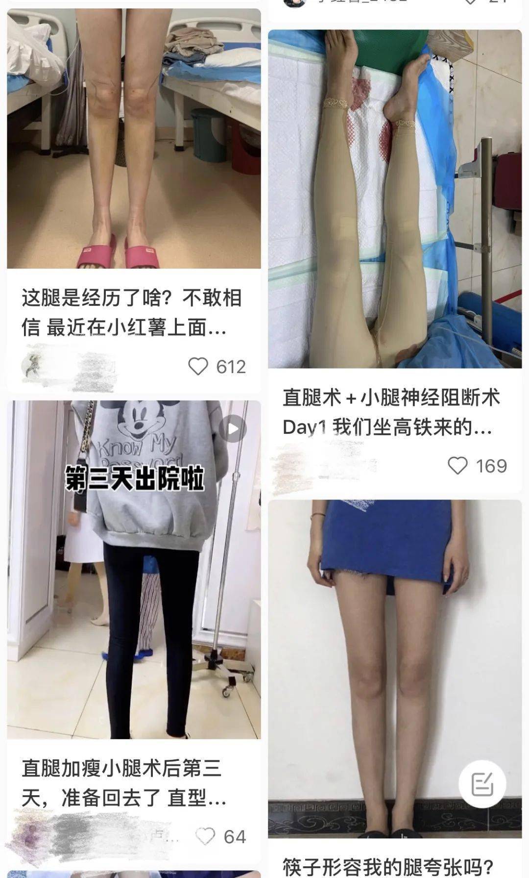 节食减肥垫高颅顶直腿手术永远焦虑的中国女孩