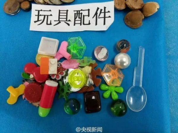 家长|家长一个月后才送医,结果…1岁男婴吞了8颗磁力珠