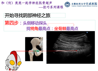 阴部|和（何）亮亮一起学超声技巧系列：超声引导阴部神经阻滞