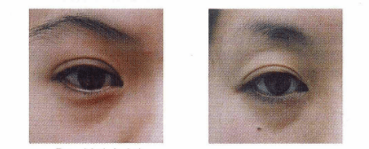 近照|曾经红极一时的“最美港姐”近照曝光，原来美人真的能被一个细节毁掉.......