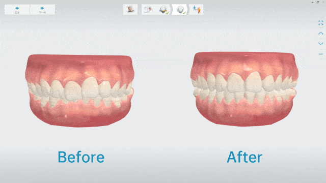 牙齿|出道前do了这里，现在的她也太惊艳了吧！