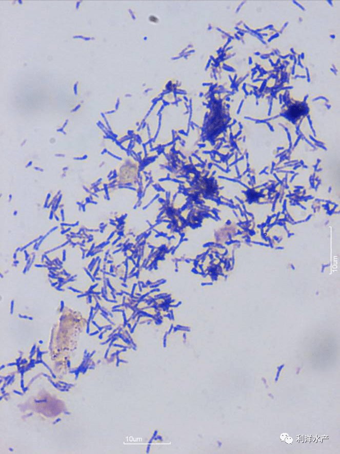 诺卡氏菌为革兰氏染色阳性丝状菌,单个,成对y或v字状排列