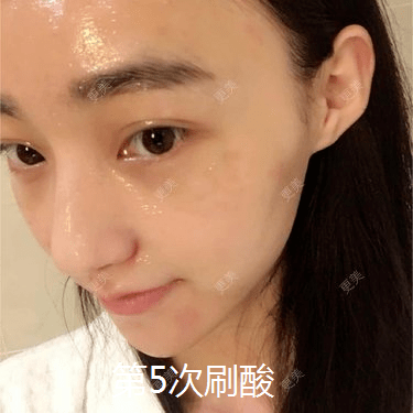 皮肤|杨幂早期合照见心机？看完原图呆了，她们这么早竟都整了...