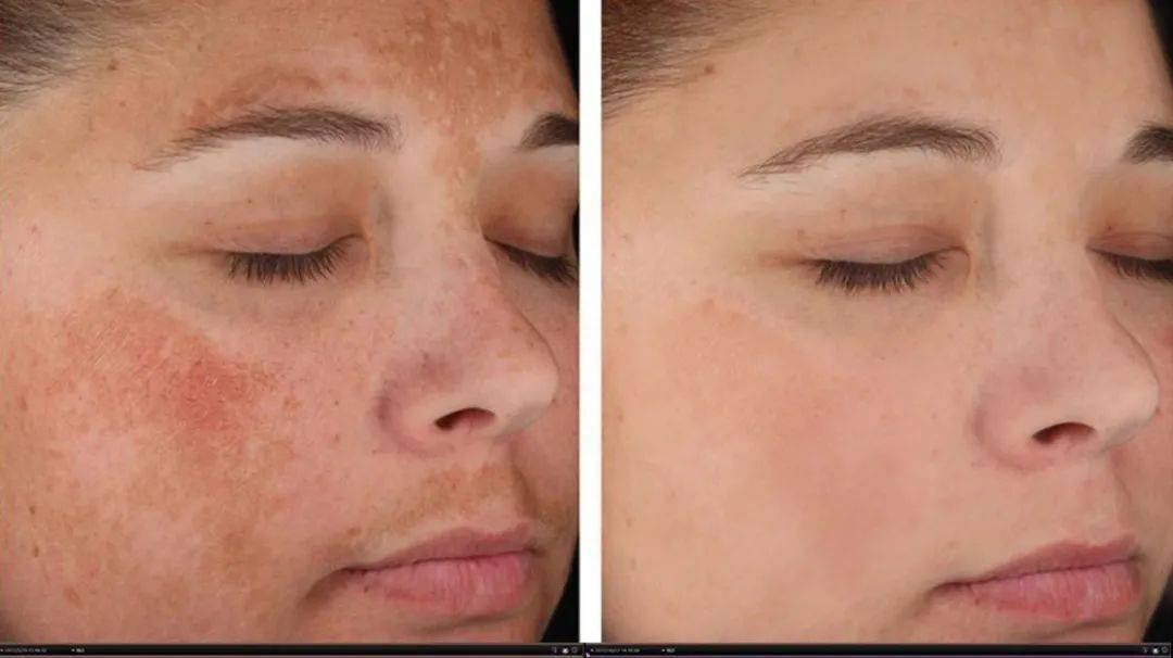 情敌|亚洲第一“鲜肉收割机”， 53岁生图曝光，成三亿女人情敌：这是什么人间尤物…