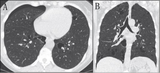 �����Է����Բ���ļ������